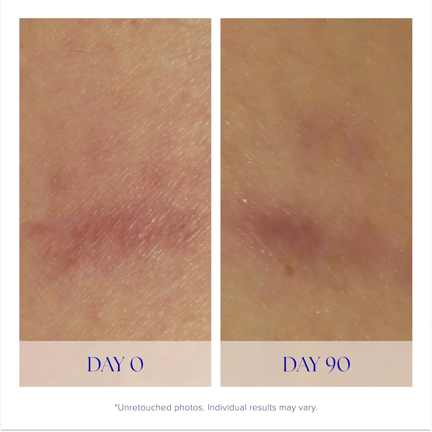 Сыворотка IS Clinical — Super Serum Advance+, антивозрастная для лица с витамином С, уменьшает рубцы и мелкие, 29.6 мл — фото 4