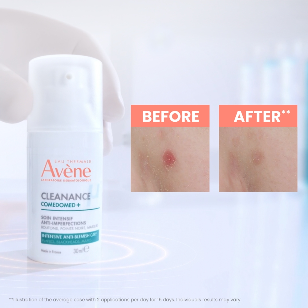 Крем для лица SPF AVENE Cleanance comedomed+ средство интенсивного ухода для проблемной кожи, склонной к акне — фото 3