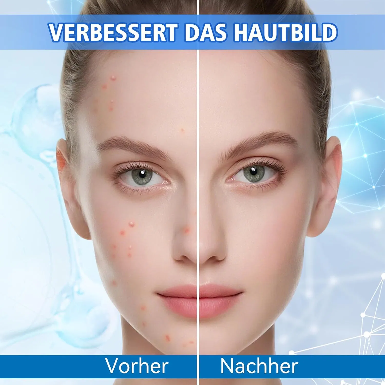 Крем для лица Bellifluous — От прыщей Anti Pimple для всех типов кожи — фото 2