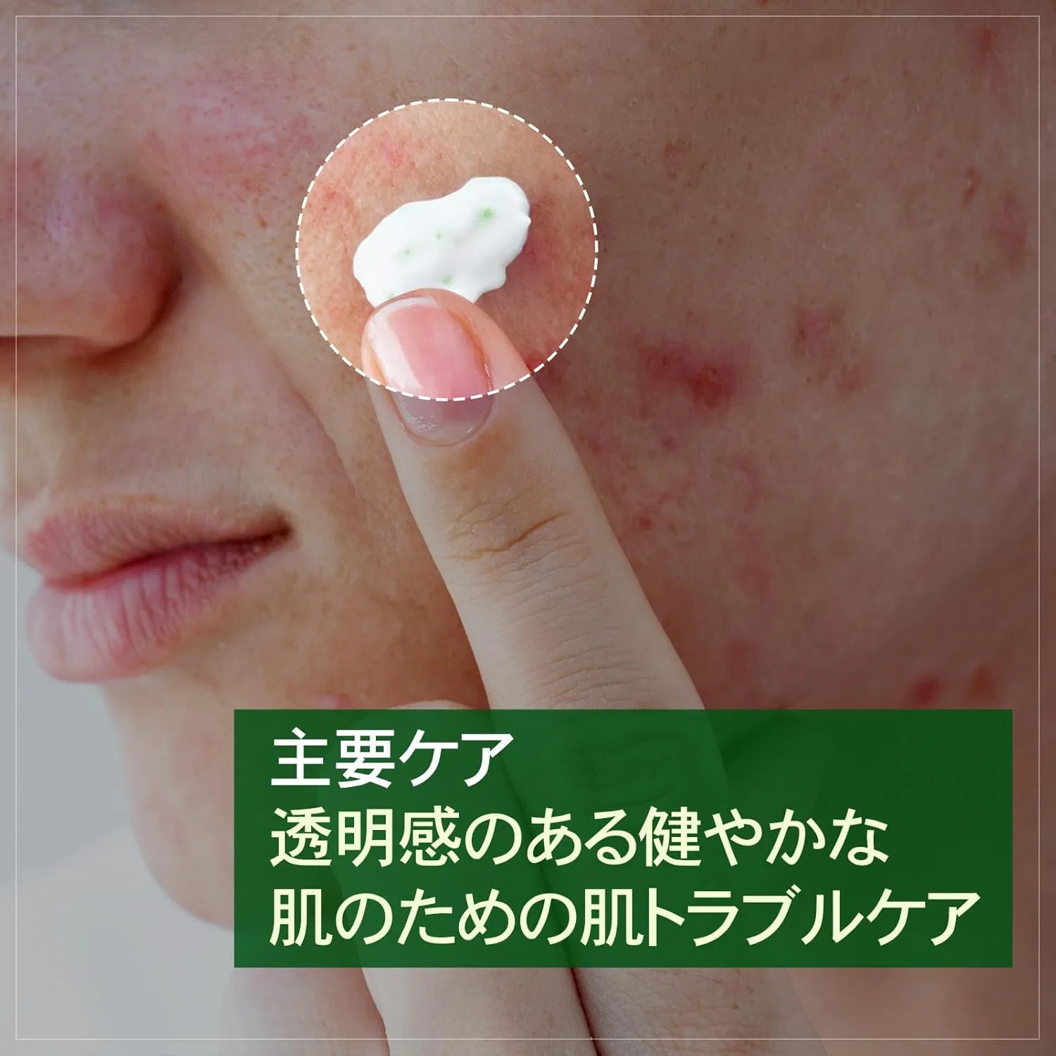 Патчи под глаза Tosowoong — Дневной Madagascar Centella Cream с центеллой, 50 мл — фото 2