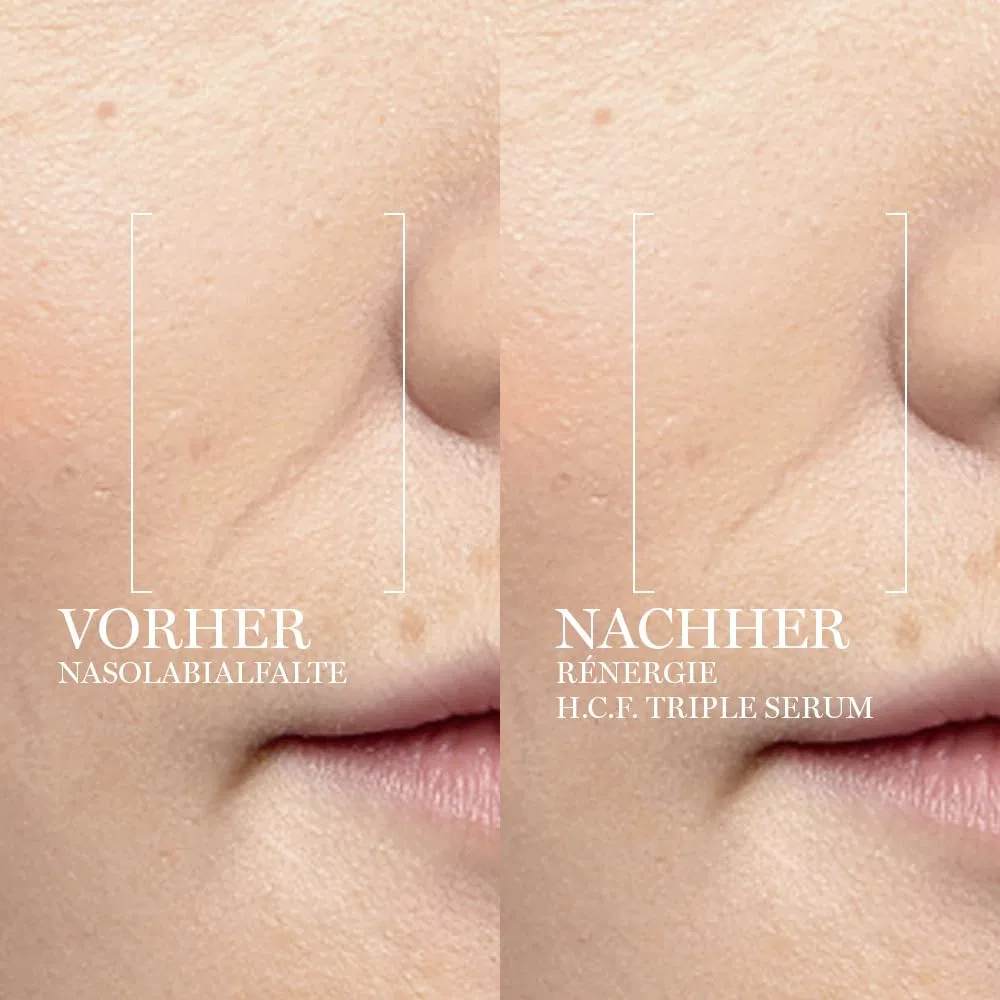 Сыворотка Lancôme — Антивозрастная для лица «Rénergie H.C.F. Triple Serum» от — фото 4