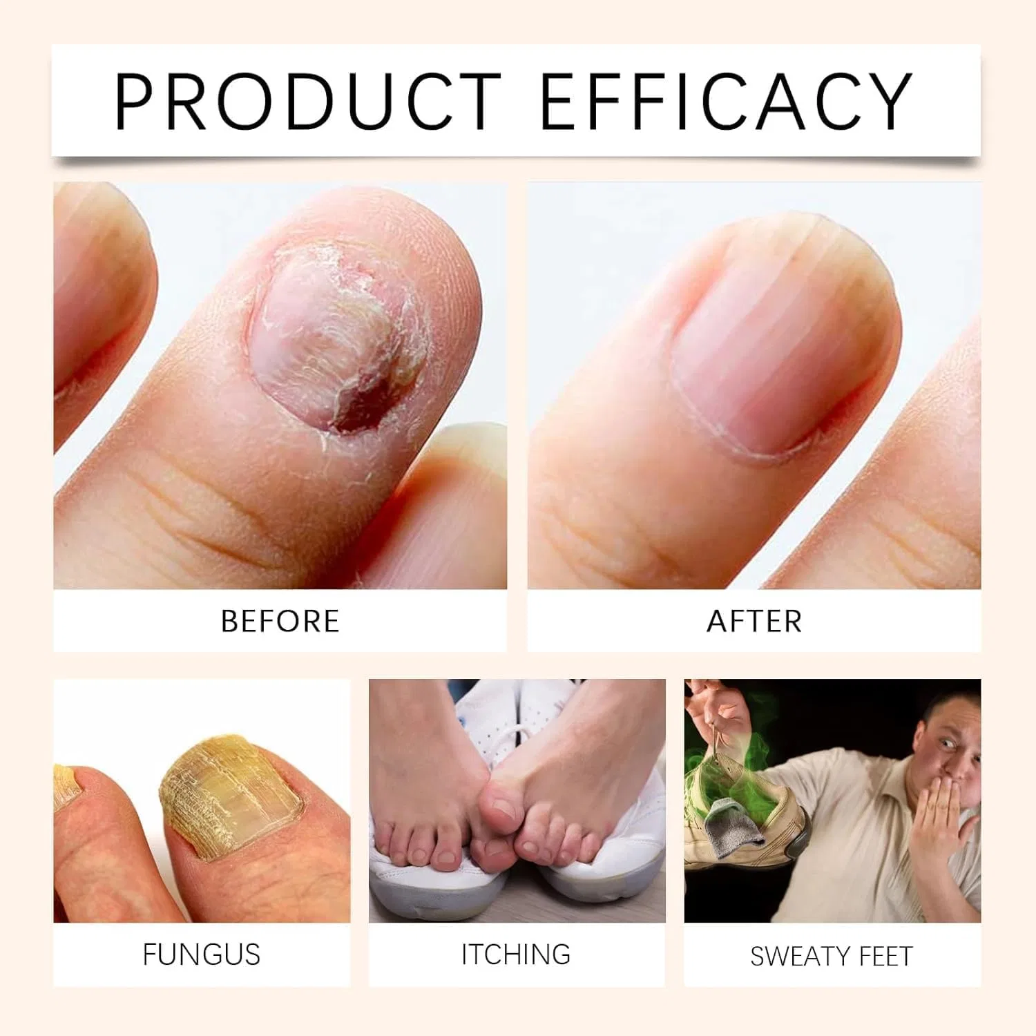 Сыворотка для ногтей с пчелиным ядом Nail Defence (2 шт.) Generisch — фото 4