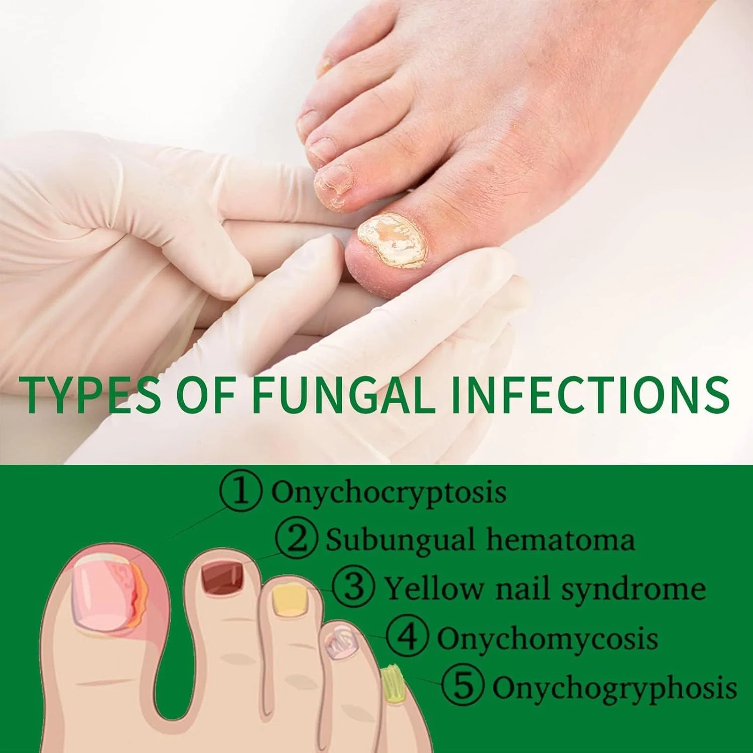 Сыворотка для роста ногтей с имбирем 7 Days Ginger Nail, 3 шт. Ylbhyirsjf — фото 4