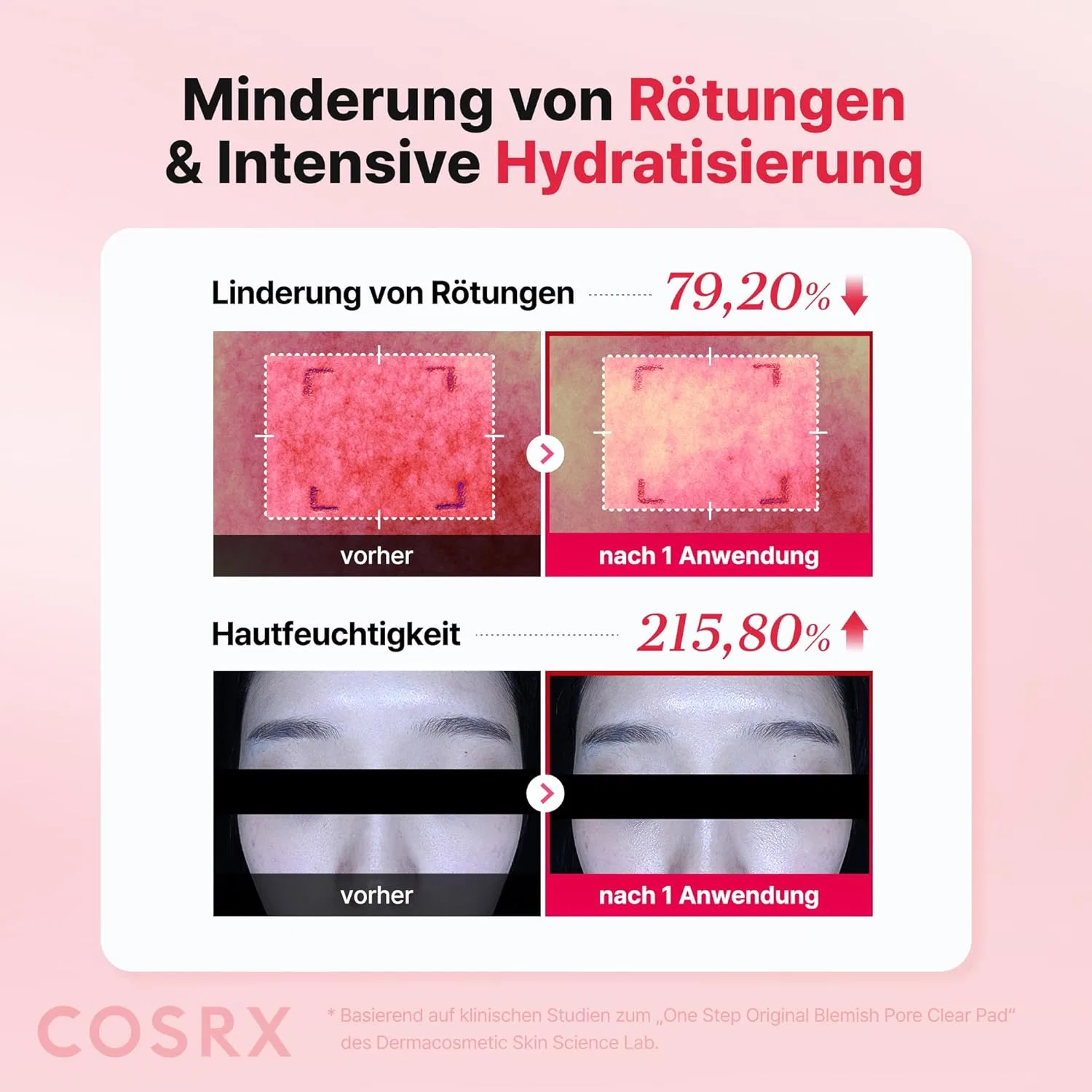 Двусторонние очищающие подушечки «OneStep Original Blemish Pore Clear Pad» от COSRX Cosrx, Red — фото 4