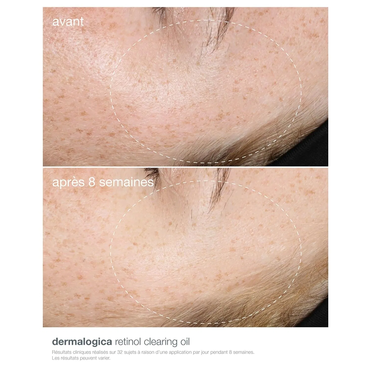 Масло для лица Dermalogica — Ночное «Retinol Clearing Oil» от — фото 3