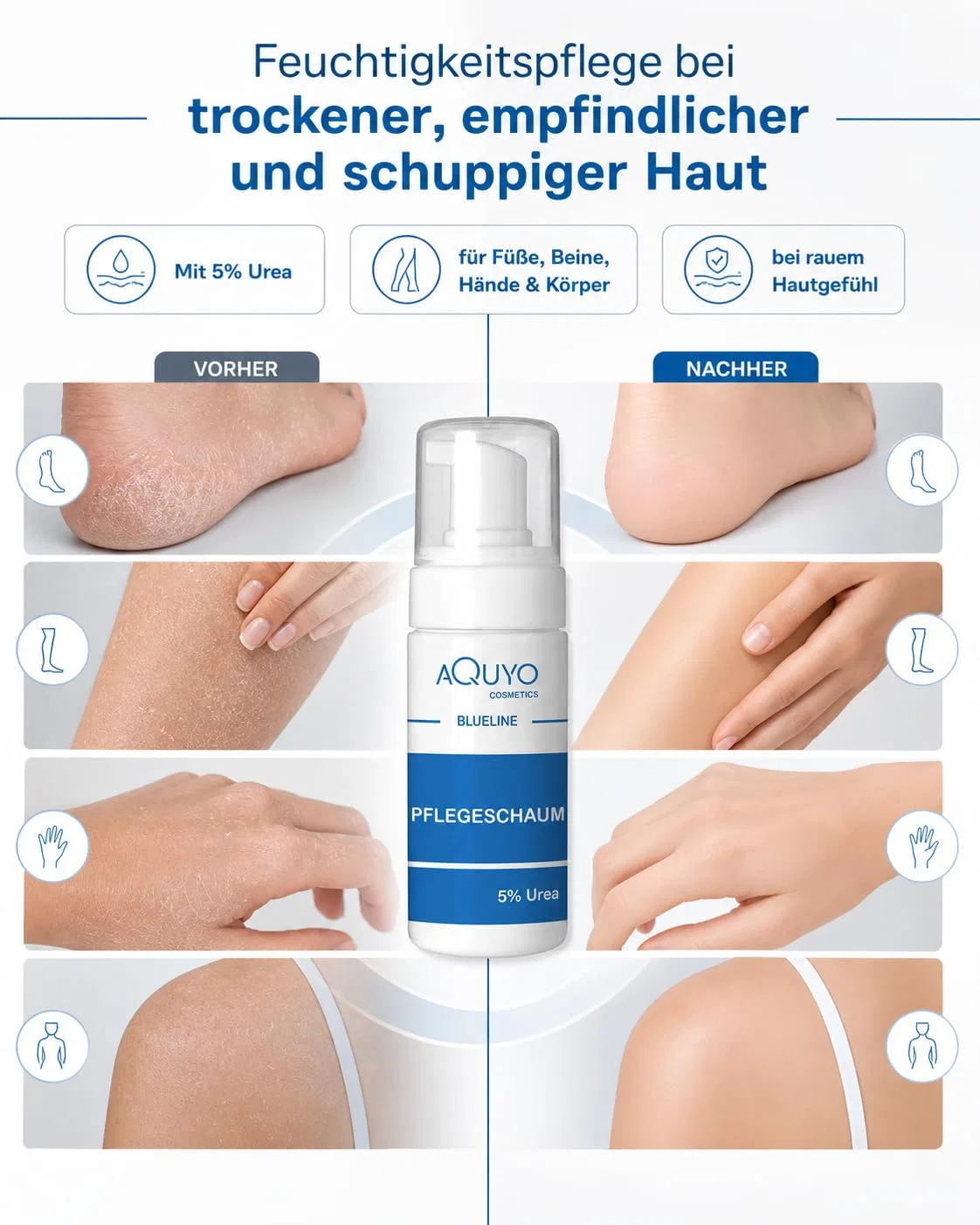 Пена Blueline с 5% мочевины для сухой кожи и ног Aquyo Cosmetics — фото 2