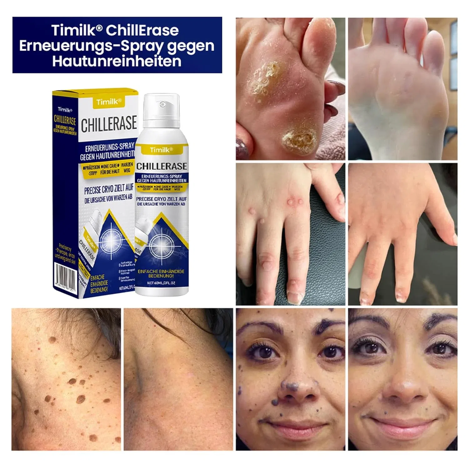 Спрей Timilk Chill Erase Bump Renewal для обновления кожи (4 шт.) Athem — фото 4