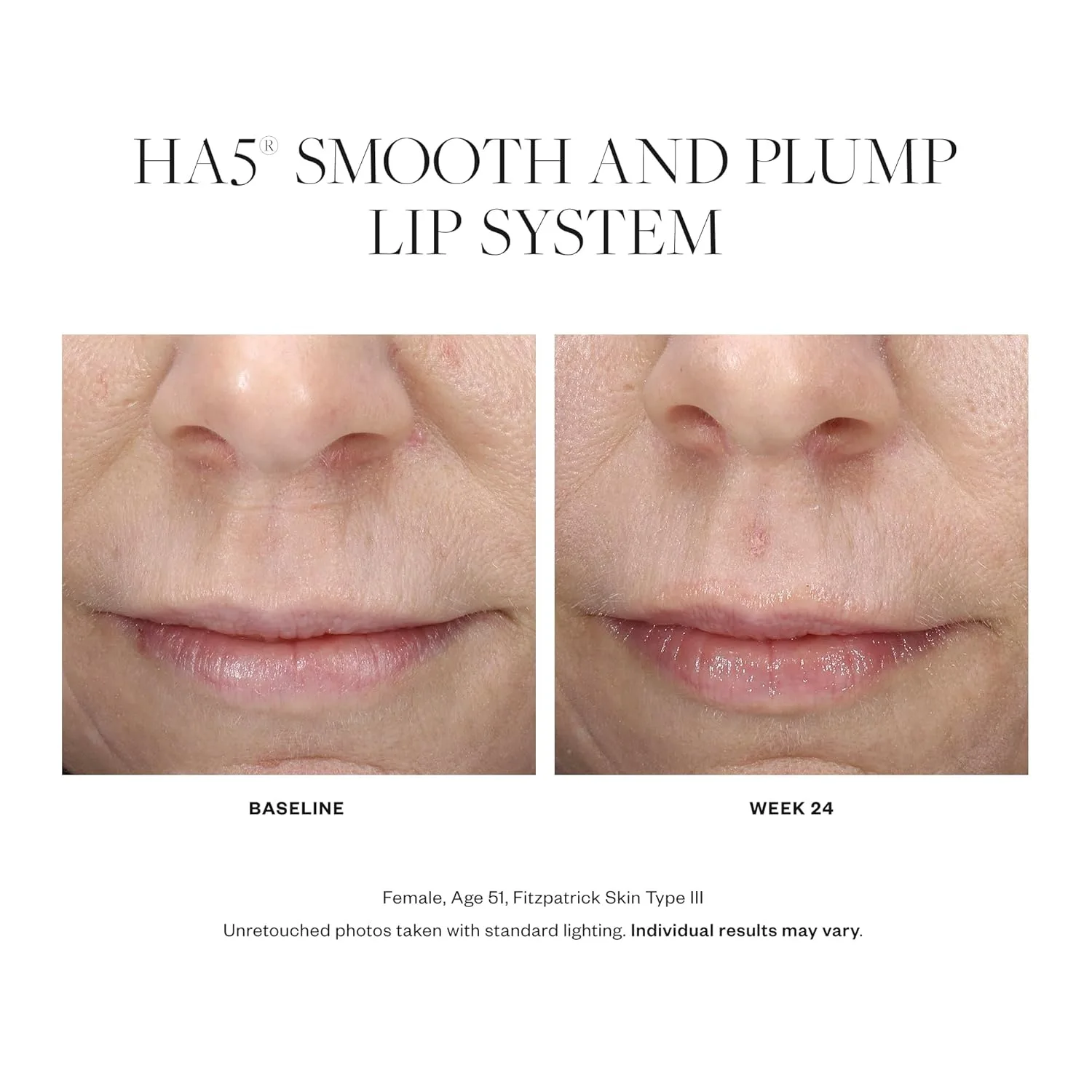 SkinMedica HA5 Smooth & Plump Lip System - увлажняющее и придающее объем средство для губ, делающее их заметно более полными и гладкими, 0,05 унции., Cream White — фото 3