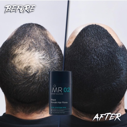 Средство для маскировки выпадения волос Mr Light Brown Hair Fibres 15g with System-Ppx for Thinning — фото 2