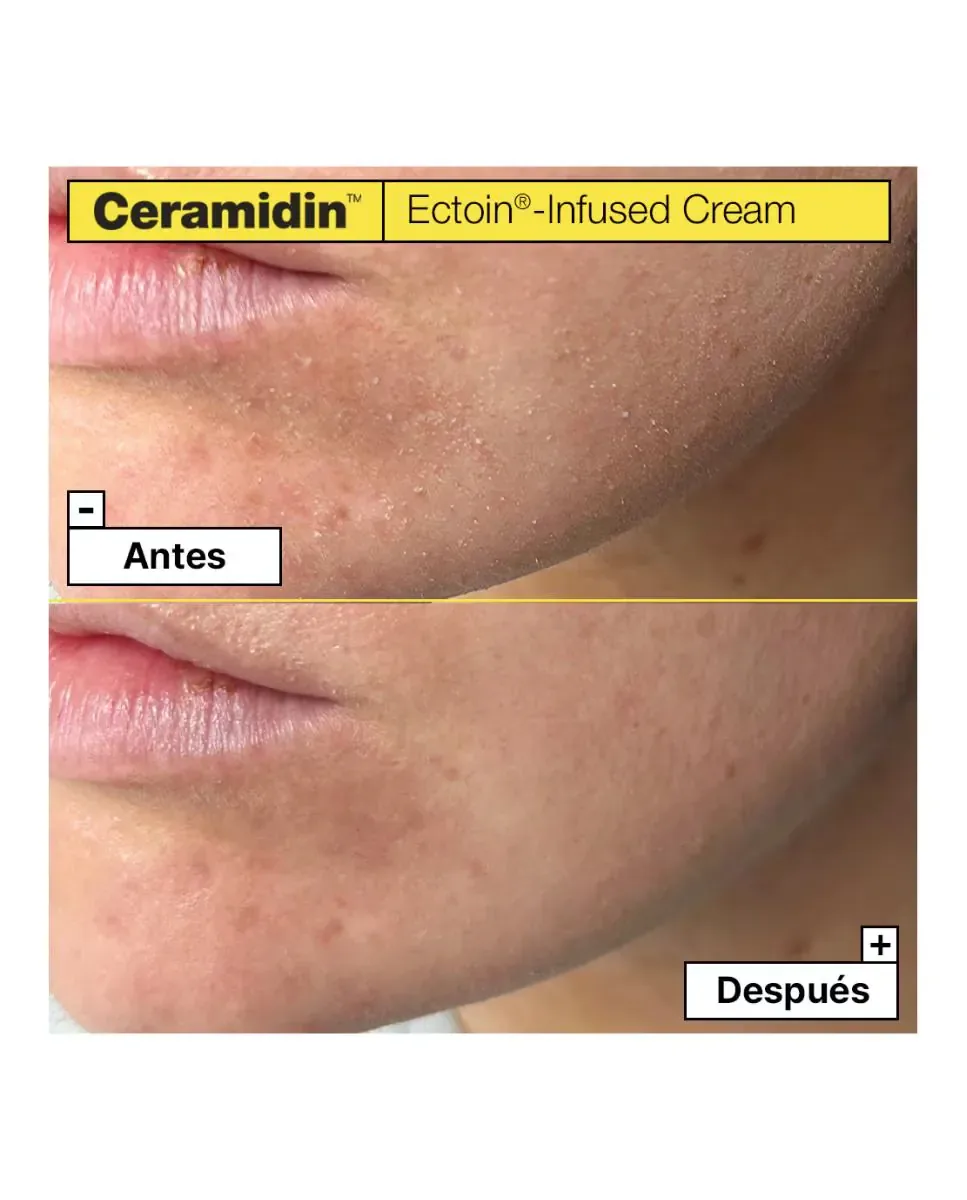 Крем для лица Dr. Jart+ — Ceramidin с эктоином, 50 мл — фото 3