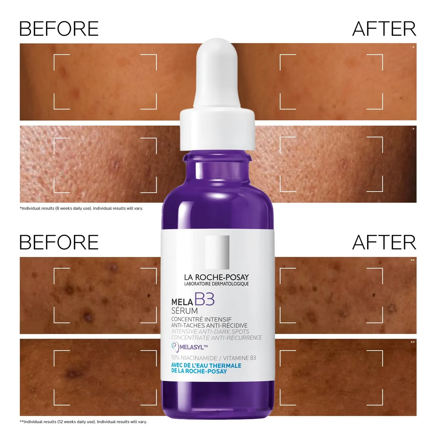 Сыворотка La Roche-Posay — MelaB3 Serum: Интенсивная против темных пятен и гиперпигментации, 30 мл — фото 3