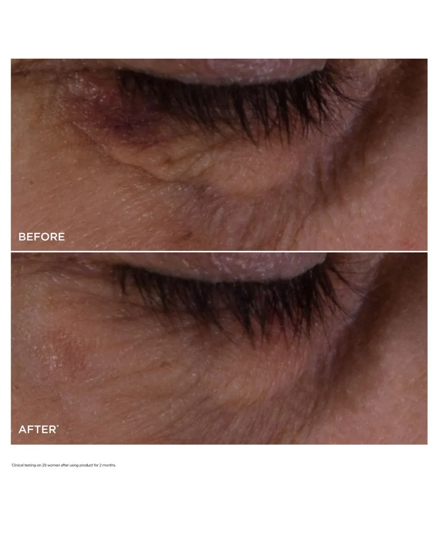 Сыворотка для контура глаз Clarins Double Serum Eye Brightening & Depuffing, 20 мл, Без цвета — фото 3