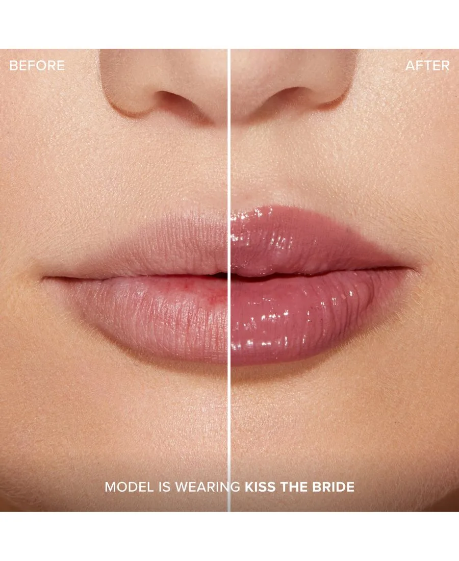 Увеличение губ с помощью инъекций для экстремального эффекта Clicks Too Faced, Kiss The Bride — фото 3