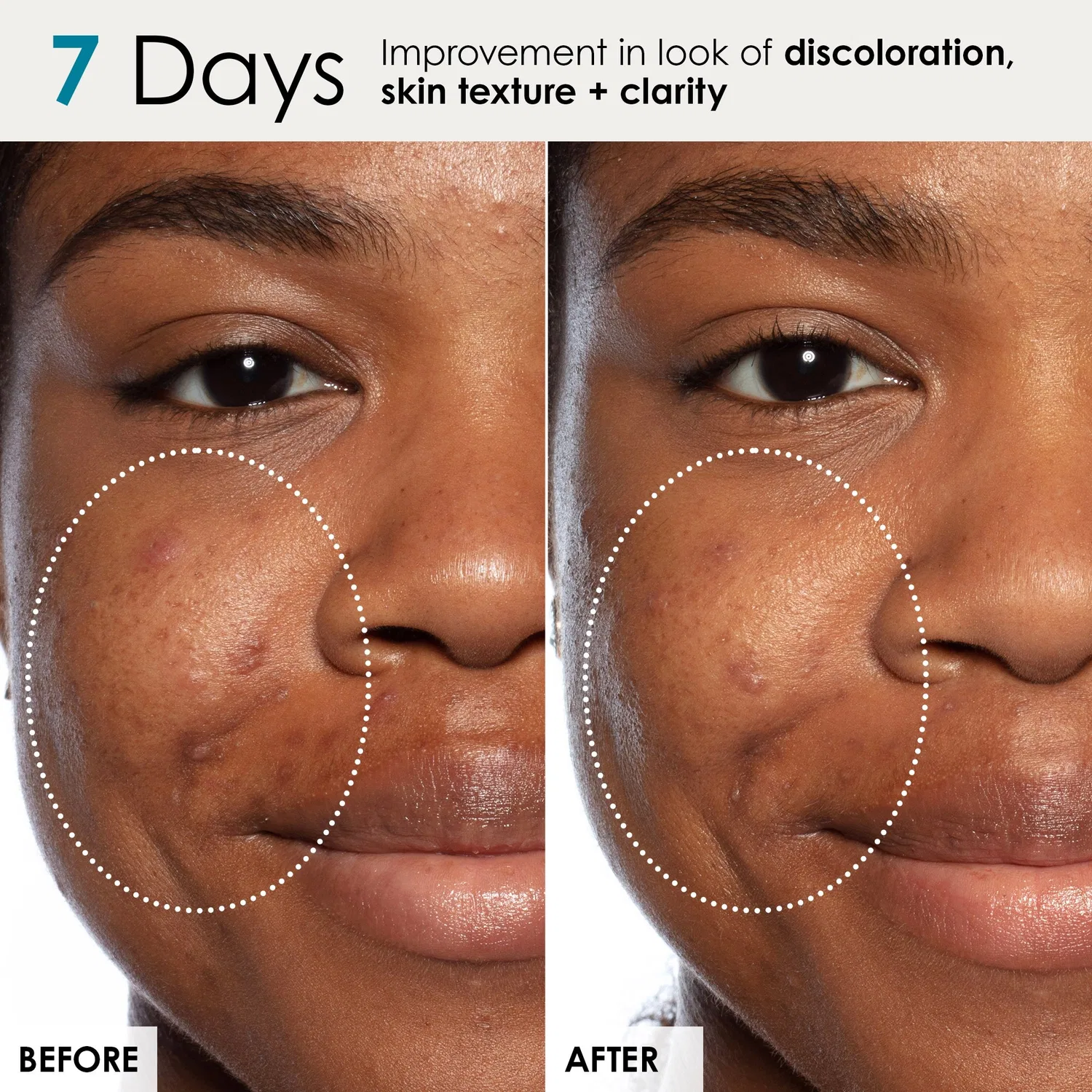 Сыворотка отбеливающая с молочной кислотой Good Genes Lactic Acid Treatment Sunday Riley, 50 мл — фото 4