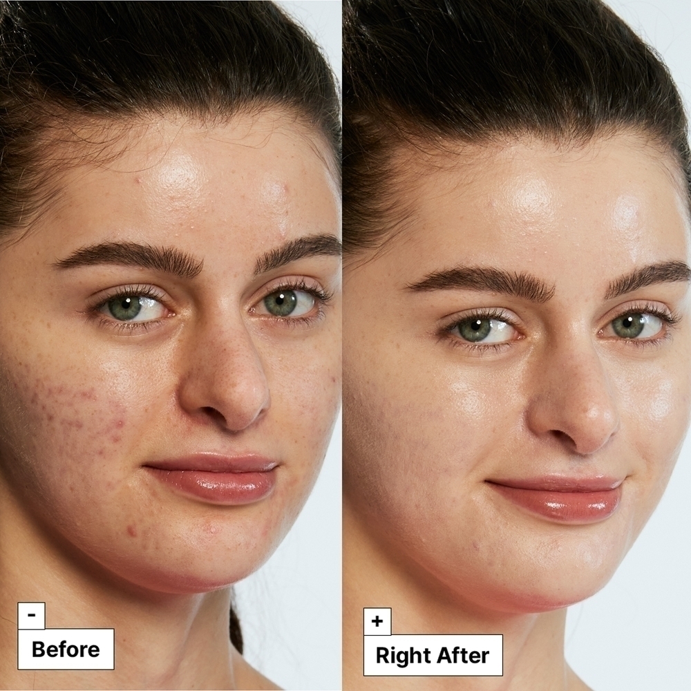 Крем для лица SPF DR. JART+ Интенсивный -корректор цвета с тигровой травой Cicapair для лечения покраснений кожи — фото 3