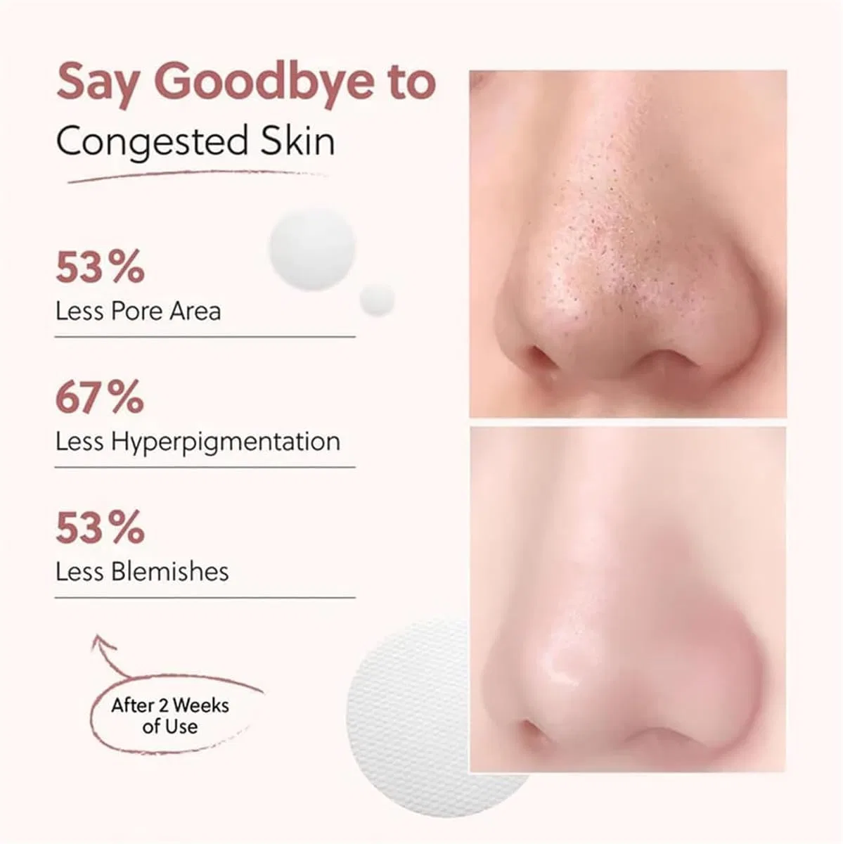 Корейские отшелушивающие подушечки Zero Pore Pads, 70 шт. ‎Generisch, 1 Piece. — фото 3