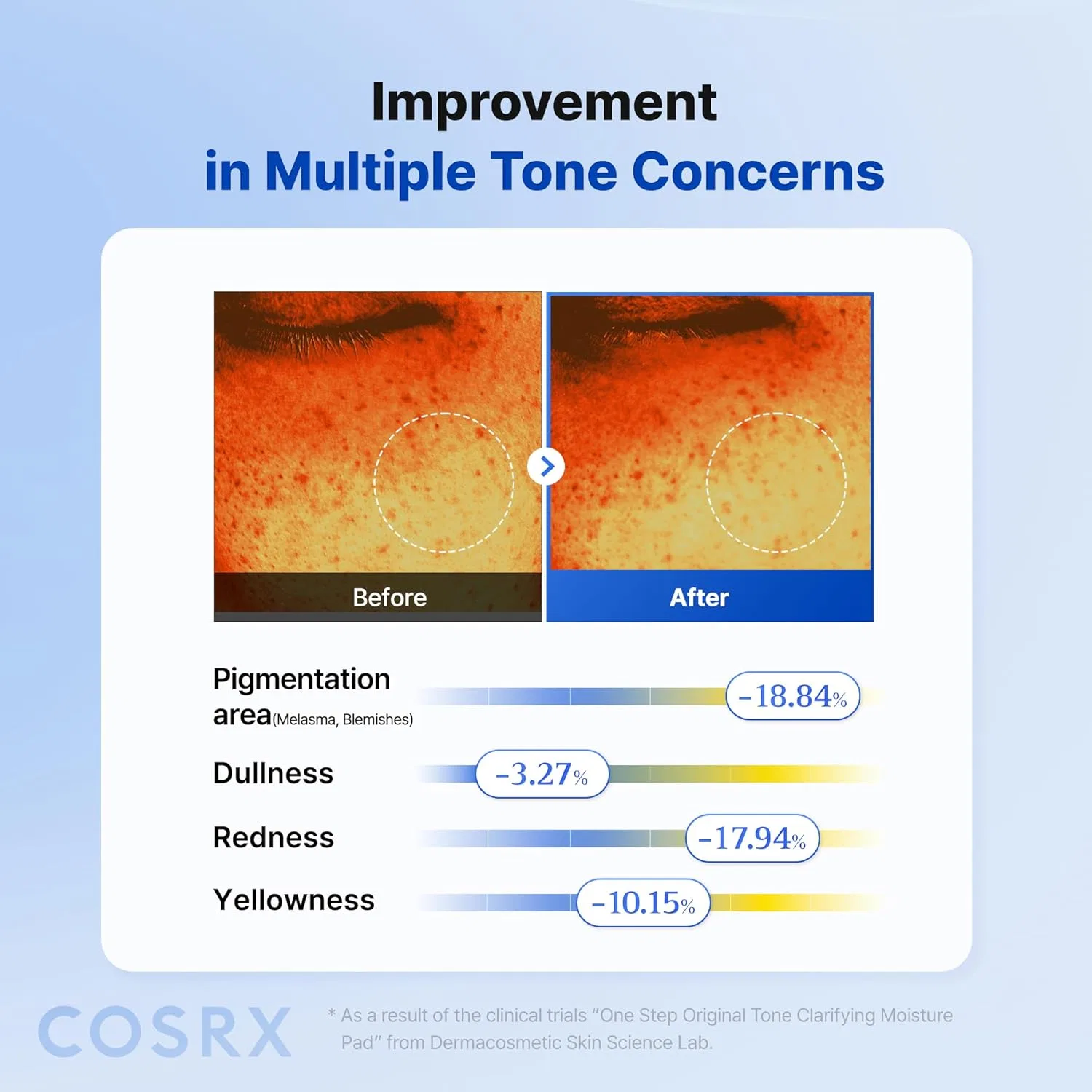 Тоник Cosrx — Ежедневные тонизирующие пэды «OneStep Original Tone Clarifying Moisture Pad» от , Blue — фото 4