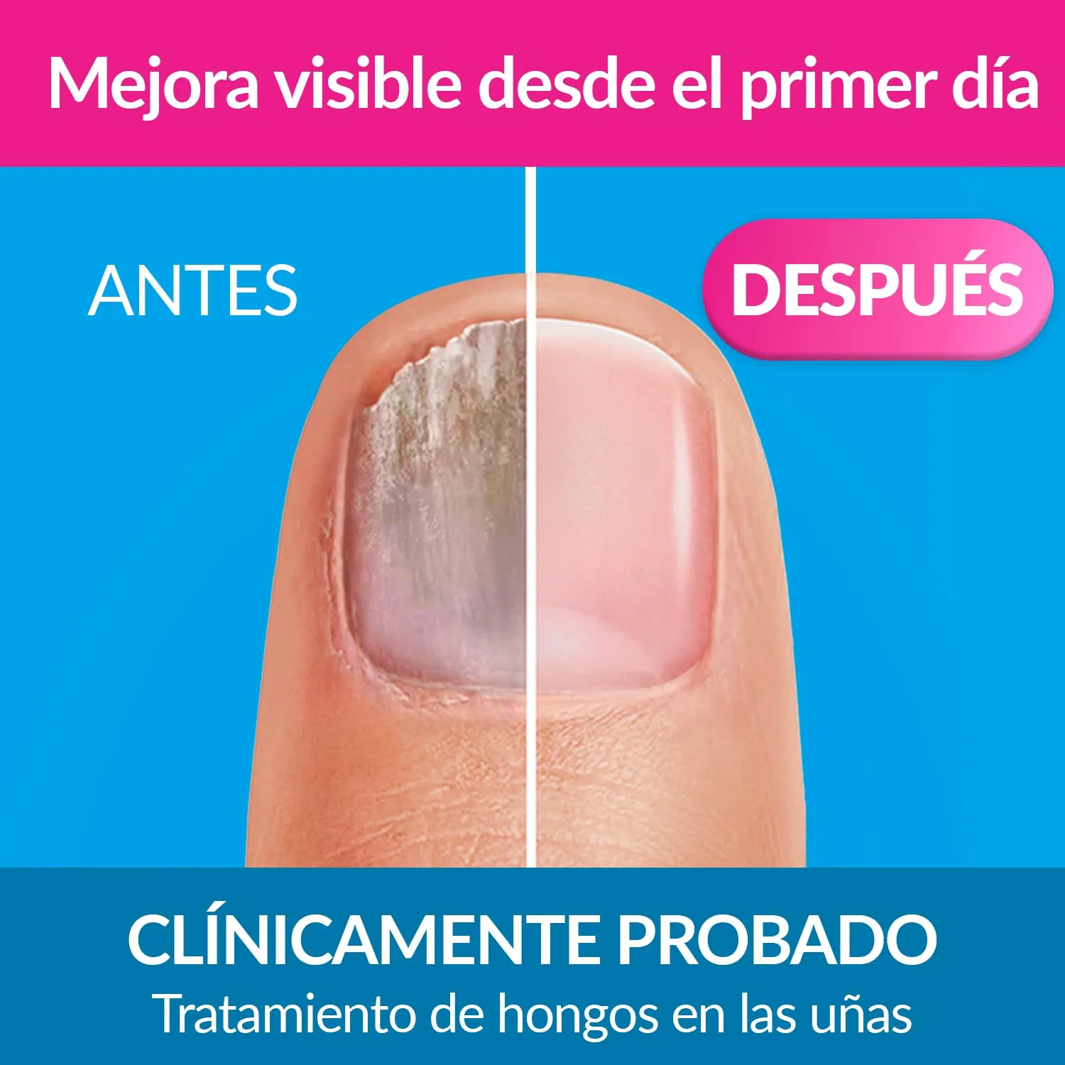 Лак для ногтей Excilor Ultra Micosis Uñas 30 мл Excilor — фото 3