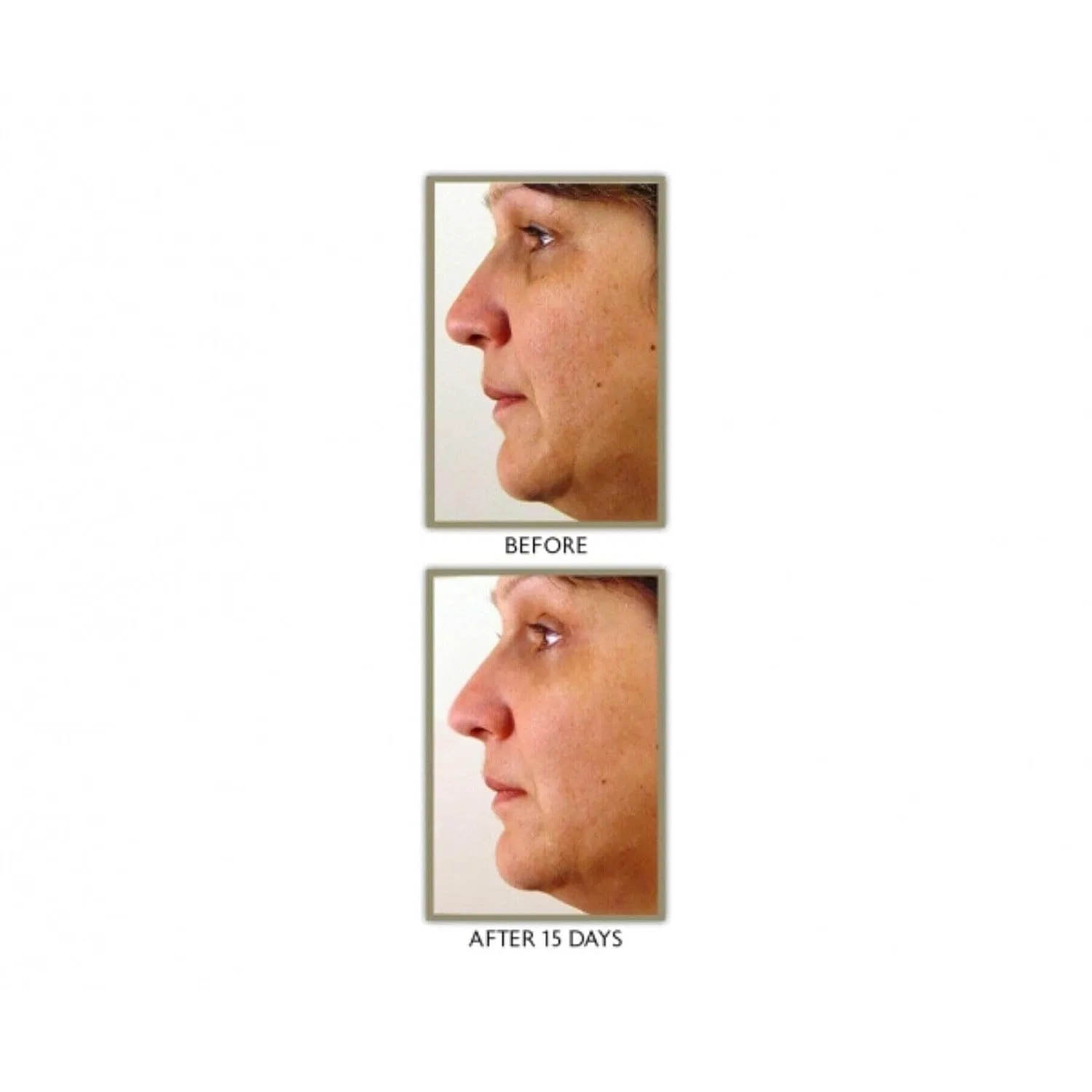 Пакетик с кремом Power Lift Treatment Cream Mirenesse, 5 г — фото 3