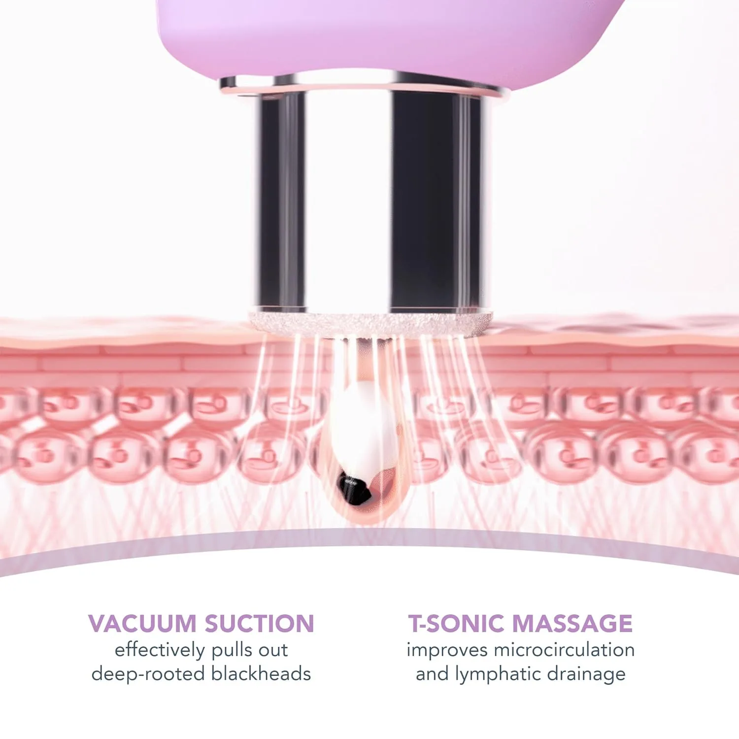 FOREO KIWI derma Машина для микродермабразии, удаление белых и черных точек для лица - инструменты для ухода за кожей - экстрактор черных точек - без пор-стрипов, вакуумный удалитель черных точек, Kiwi Derma — фото 3