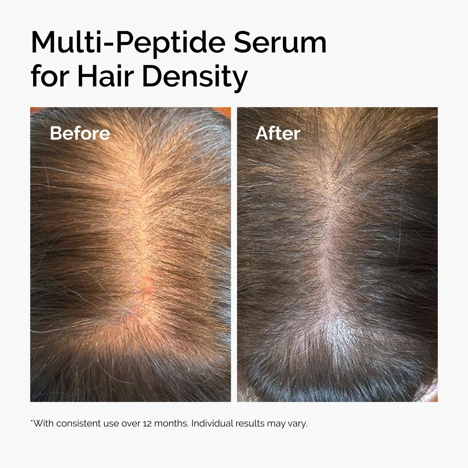 Сыворотка для плотности волос Multi-Peptide Serum for Hair Density The Ordinary, 30 мл — фото 2