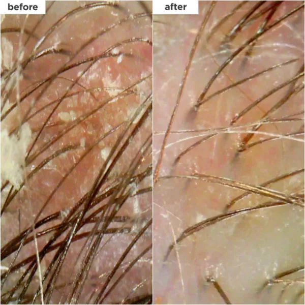 Шампунь-Скраб для кожи головы Scalp Revival с микроотшелушивающим углем и кокосовым маслом Briogeo, объем 227 мл — фото 3
