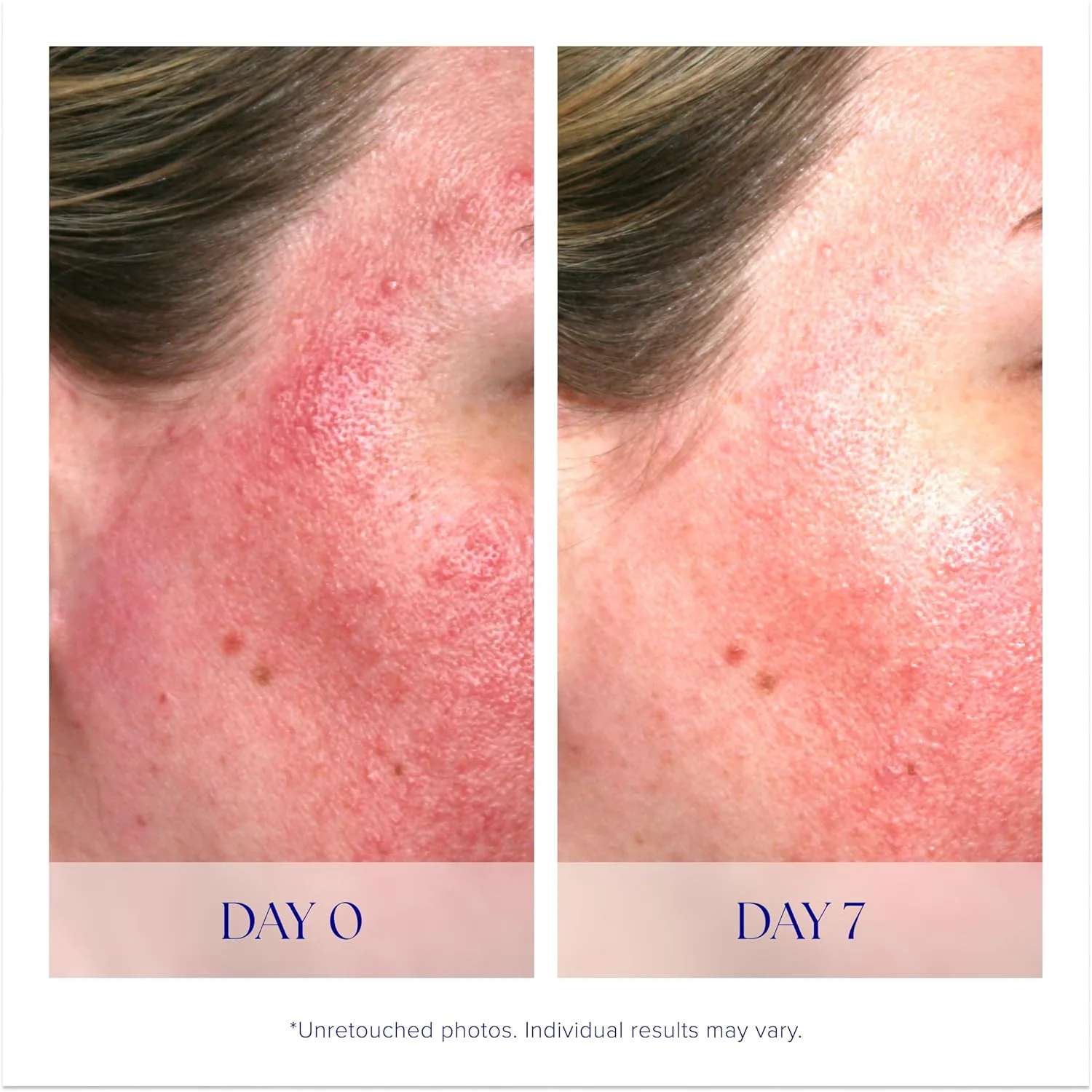 Сыворотка IS Clinical — Pro-Heal Serum Advance+ - с витамином С, богатая антиоксидантами, успокаивает — фото 4