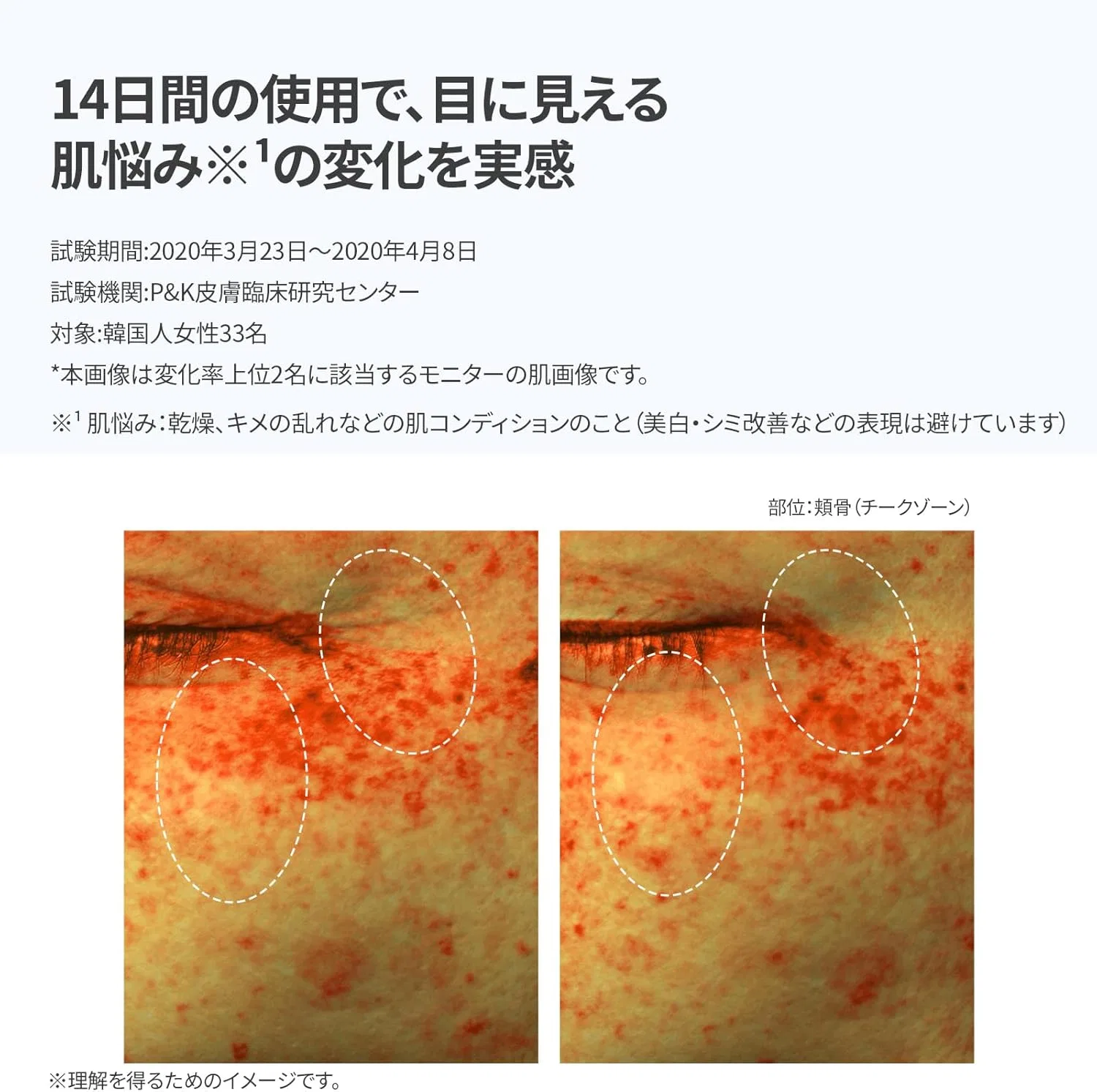 Эссенция IOPE — Осветляющая Brightening Dark Spot Essence, 45 мл — фото 4