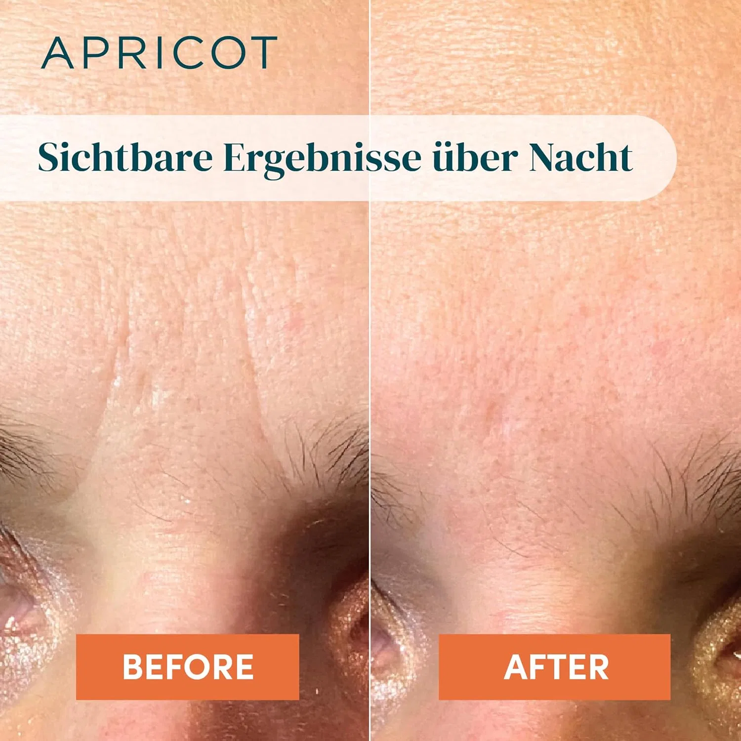 Патчи от морщин «It's a Skin vestment» с ниацинамидом от APRICOT, 120 шт. Apricot Beauty & Healthcare, Niacinamide For Oily Or Large-Pored Skin — фото 4