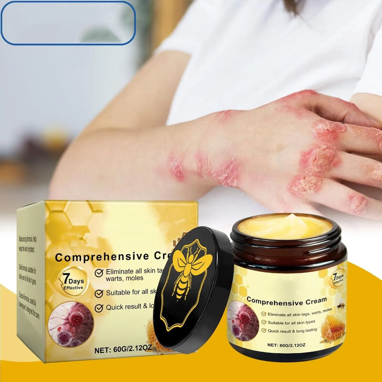 Крем для тела, Bienengift Komplettcreme, 3 шт, 60 г Generisch — фото 2