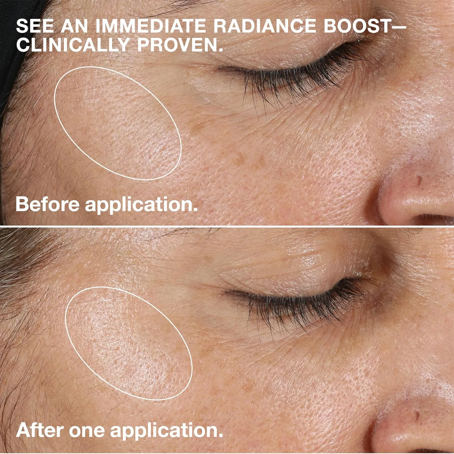 Тоник Clinique — Step Clarifying Lotion Face Exfoliator | с гамамелисом и салициловой кислотой | Для очень, 198 мл — фото 3