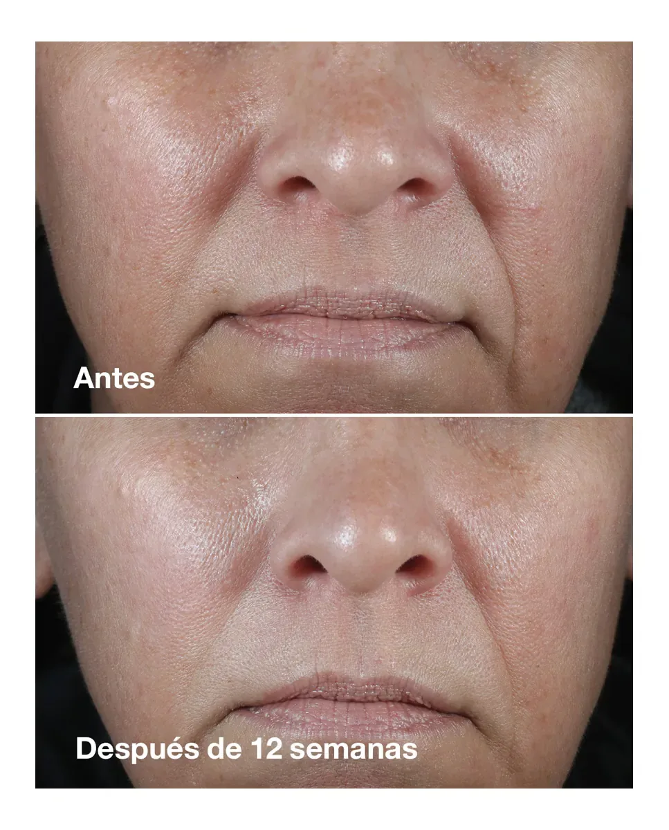 Крем для лица Clinique — Увлажняющий против морщин Wrinkle Correcting Rich Cream Smart Clinical Repair для сухой, 50 мл — фото 3