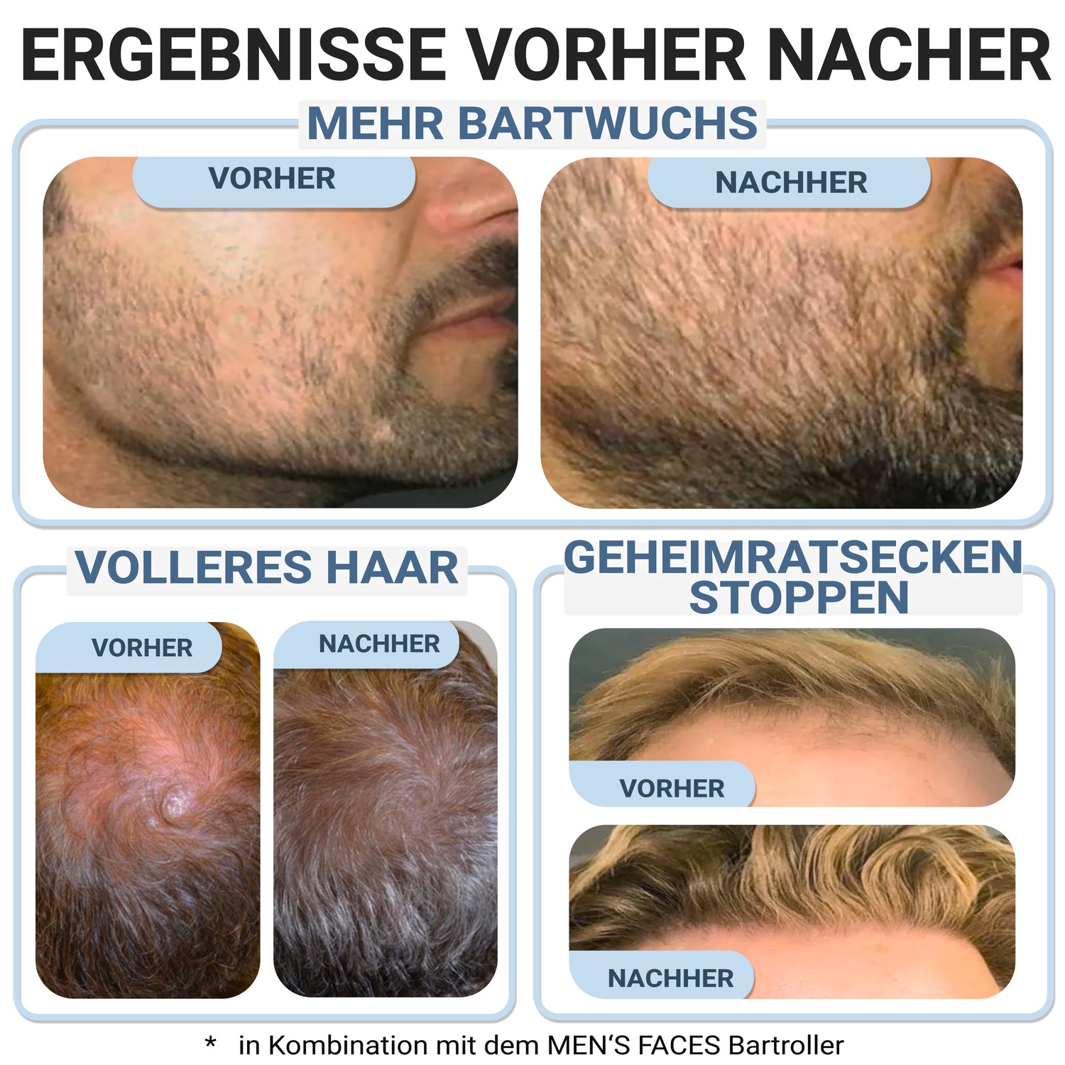 Сыворотка для волос haar- & bartwuchs serum 50 ml Mens Faces, объем 50мл — фото 4