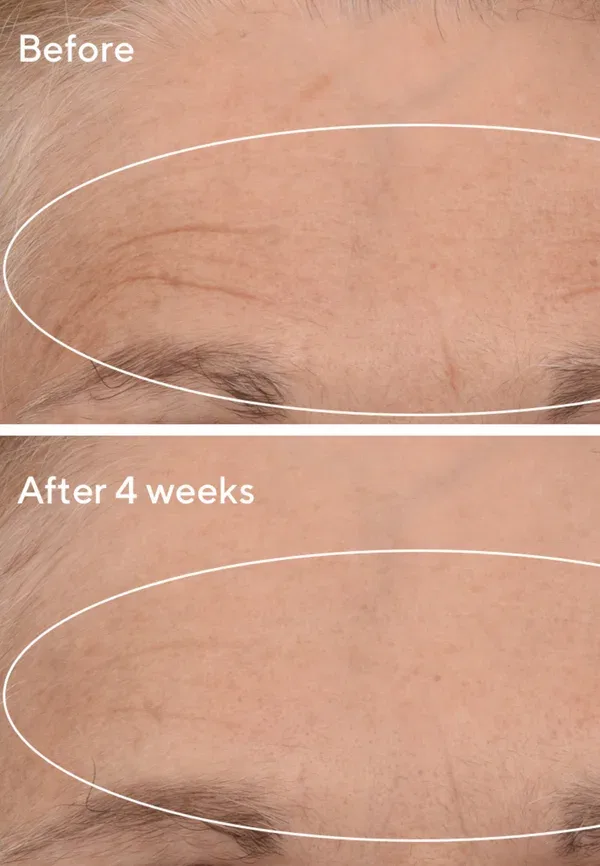 Сыворотка ретинальная для лица, 15 мл, Retinal resculpt overnight treatment travel, Murad — фото 3