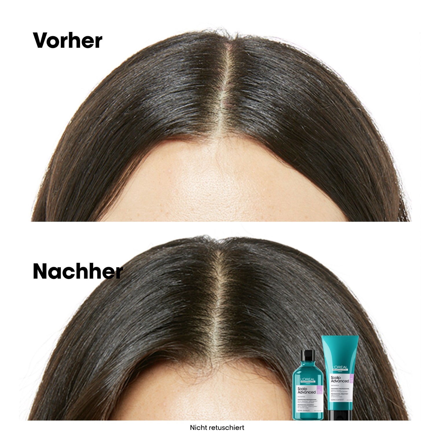 Шампунь serie expert scalp advanced anti-discomfort dermo-regulator L Oreal Professionnel Paris, объем 300 мл — фото 3