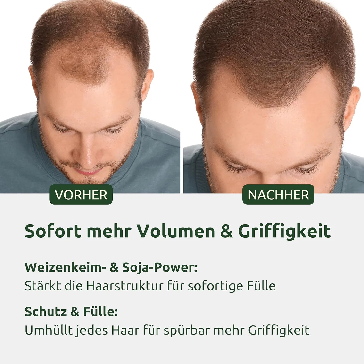 Мужской активатор роста волос Biotin + Rosemary от Biotin Hiluva — фото 4