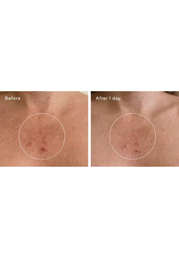 Боди-бальзам с салициловой кислотой Retexturizing Body Pads Murad 180 мл — фото 4
