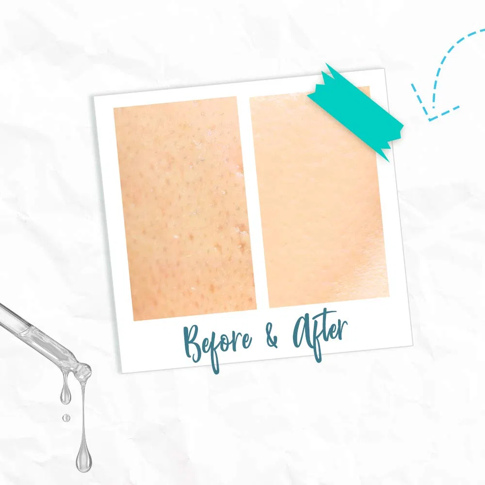 Сыворотка Bye Bye Blemish — Для лица Skin Rescue Niacinamide Serum — фото 4