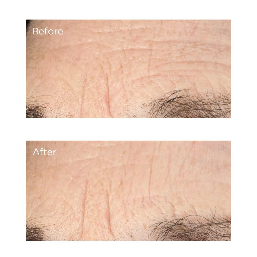 Сыворотка «Essential Fx Acyl-Glutathione Deep Crease Serum» от Perricone MD (30 мл) Perricone Md — фото 4
