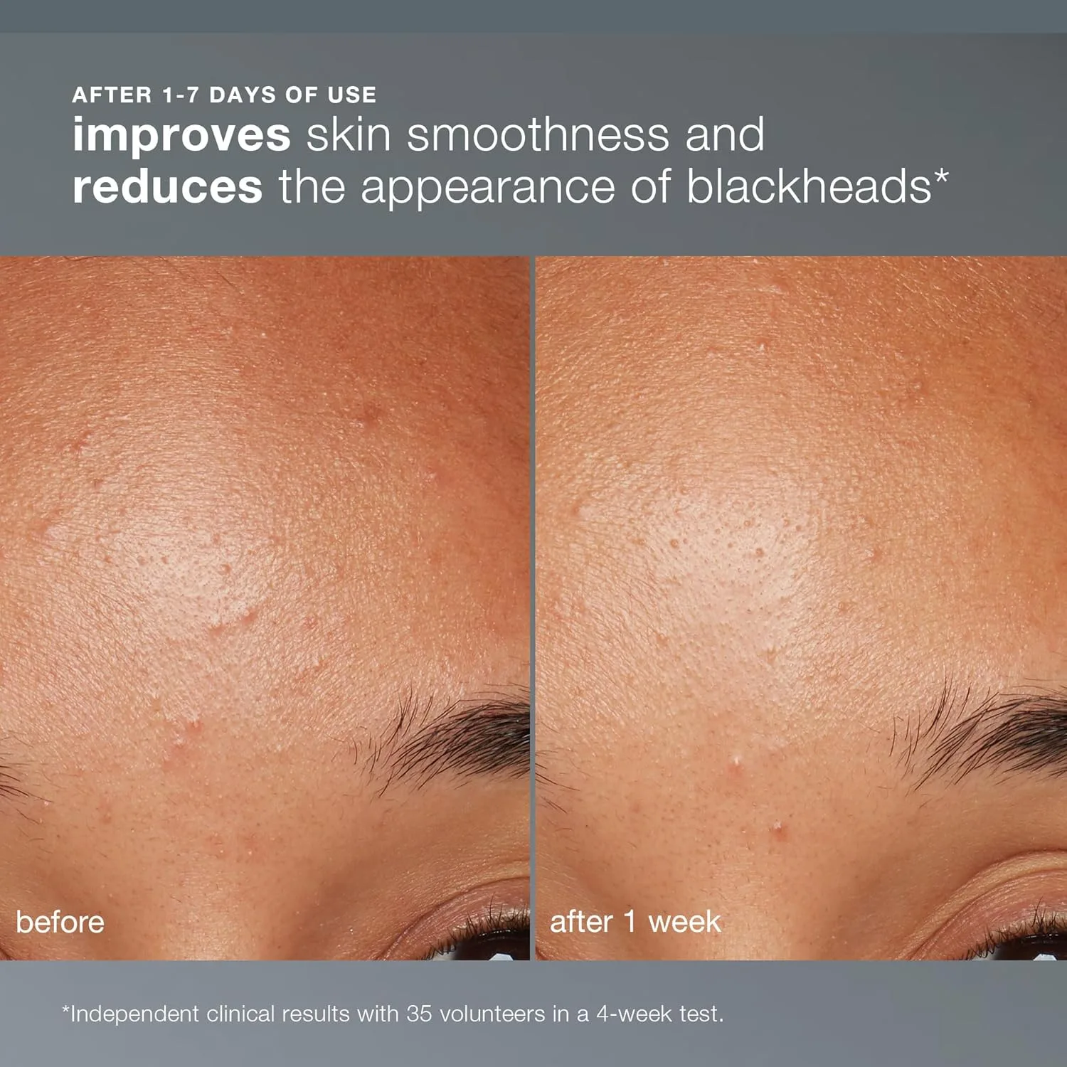 Скраб-пудра для лица Dermalogica Daily Microfoliant с салициловой кислотой и ферментом папайи - для сияющей и гладкой кожи каждый день. 12.76 г (1 шт.) — фото 3
