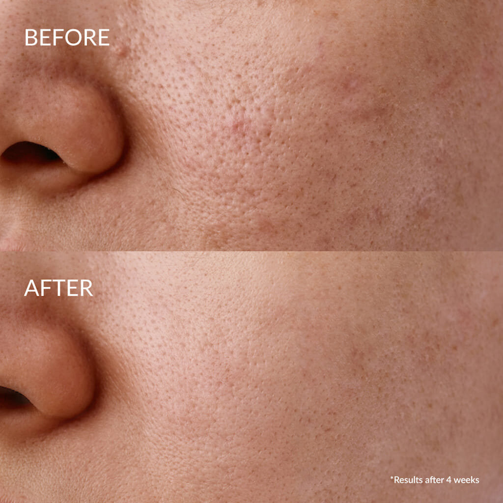 Сыворотка — Ирен Шизен, Регенерирующая для лица – Glow-Getter Renewal Serum, Inna Marka, 20 мл — фото 2