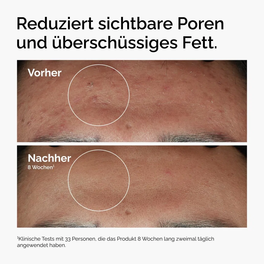 Сыворотка The Ordinary — Niacinamide % + Zinc % от — фото 2