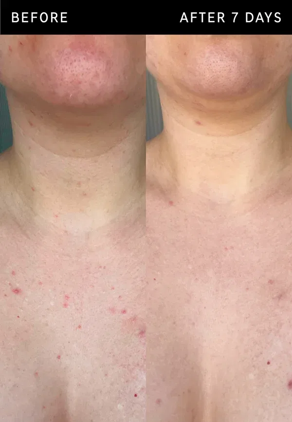 Пилинг-стик с гликолевой кислотой, для сухой кожи, Glycolic acid exfoliating body stick, The Inkey List, 45 г — фото 3