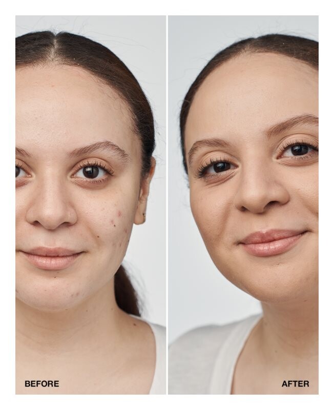 Тональный крем SPF 20 Clinique Even Better Clinical Serum Foundation SPF 20, оттенок CN 52 Neutral 30 мл — фото 3