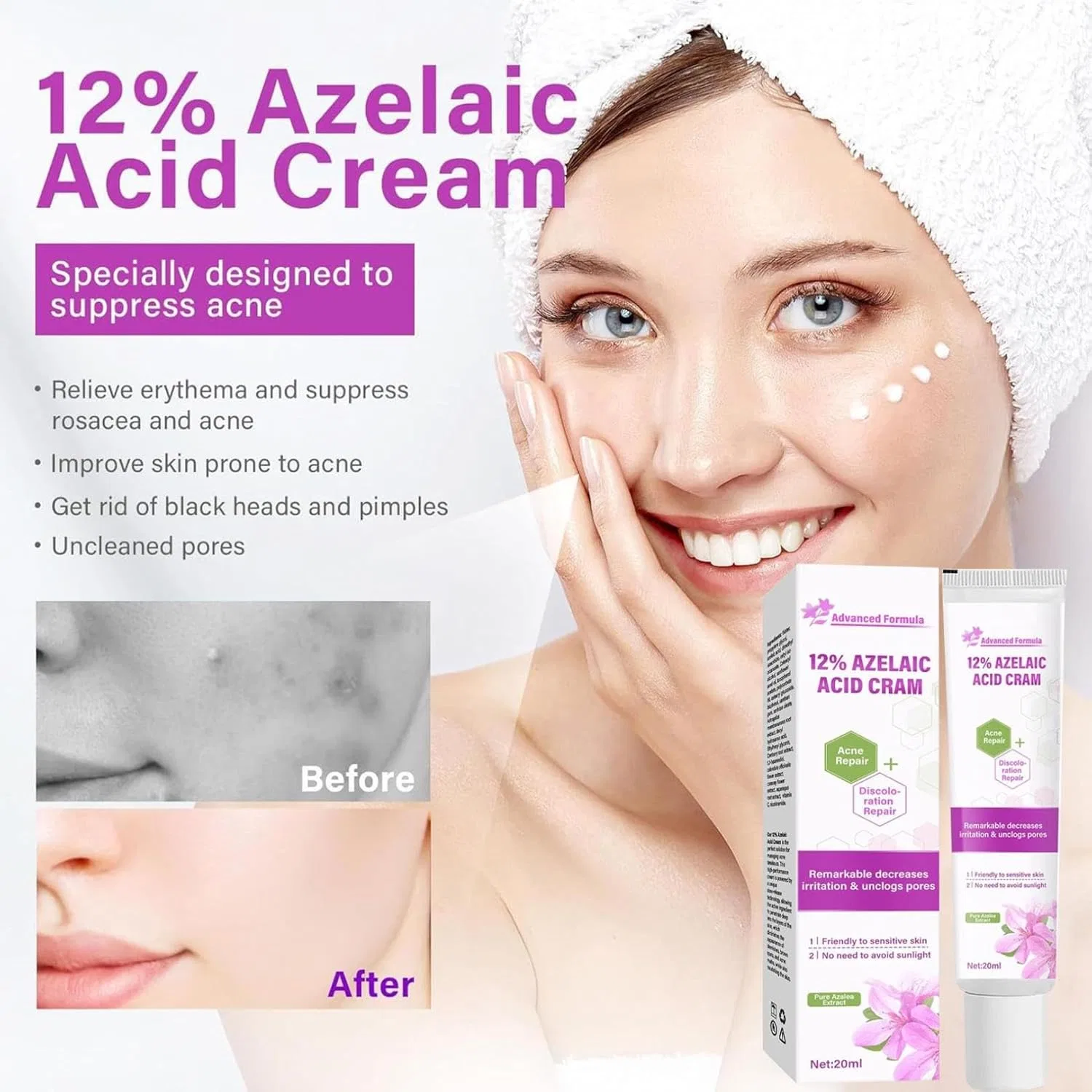 Крем для лица 12% Azelaic Acid, Generisch, 1 шт. — фото 2