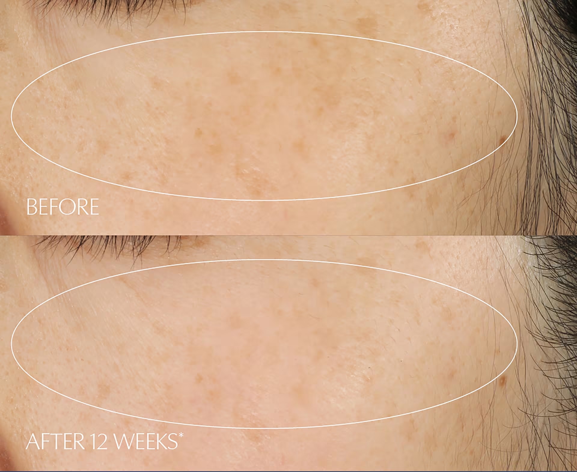 Сыворотка Estée Lauder — Для лица Estee Advanced Night Repair Multi-Recovery, 75 мл — фото 4