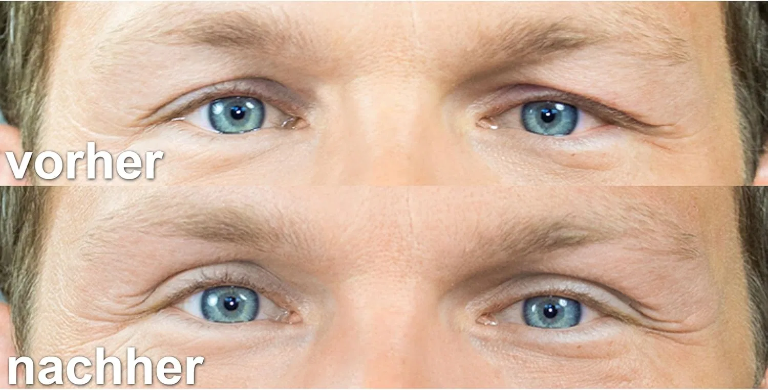 Лента для подтяжки век «lady size» (L) от EYELID TAPE Schlupflid Weg. Natürlich Schöne Augenblicke. — фото 4
