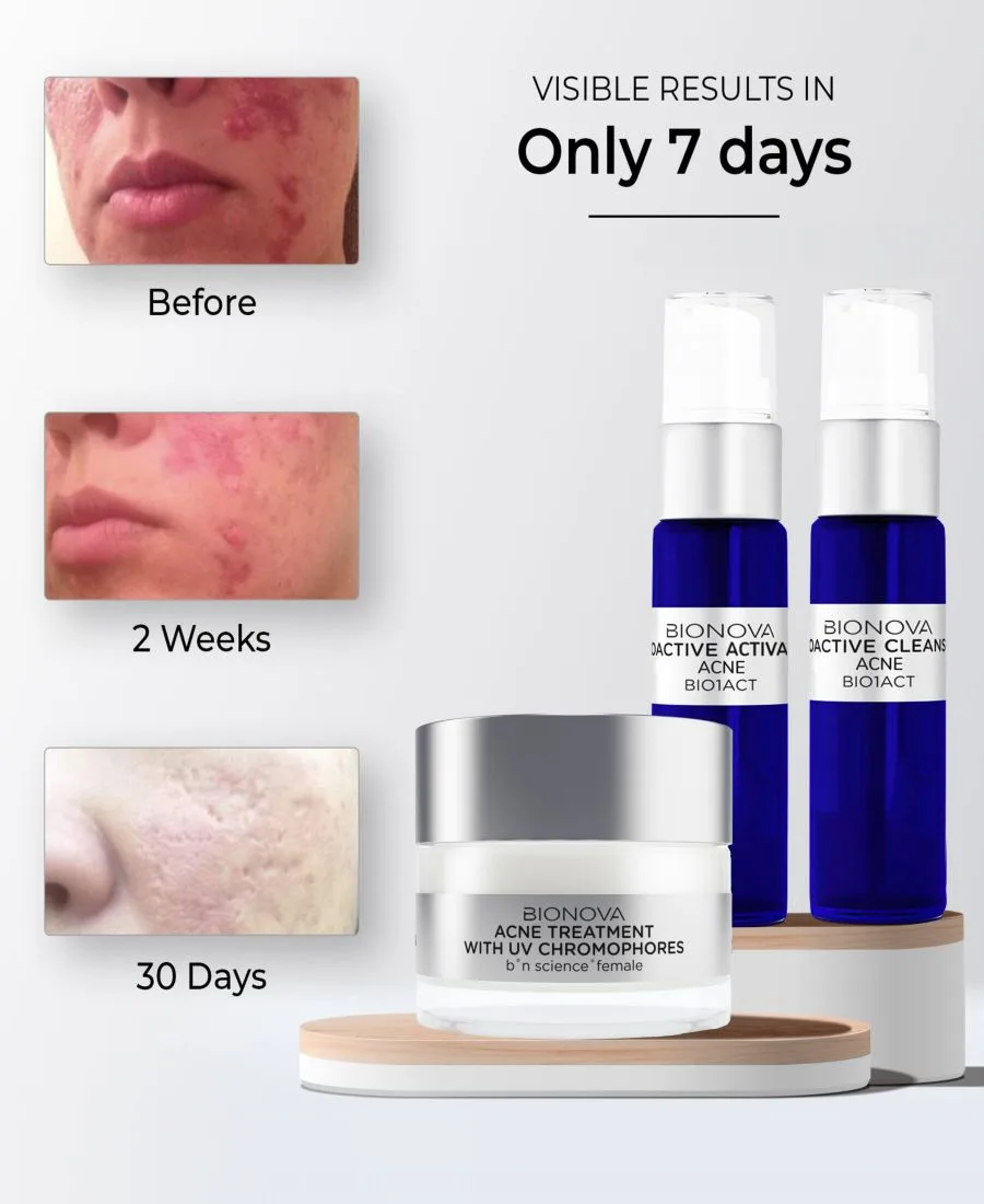 Bionova Коллекция средств от прыщей Acne Discovery с УФ-хромофорами — фото 4