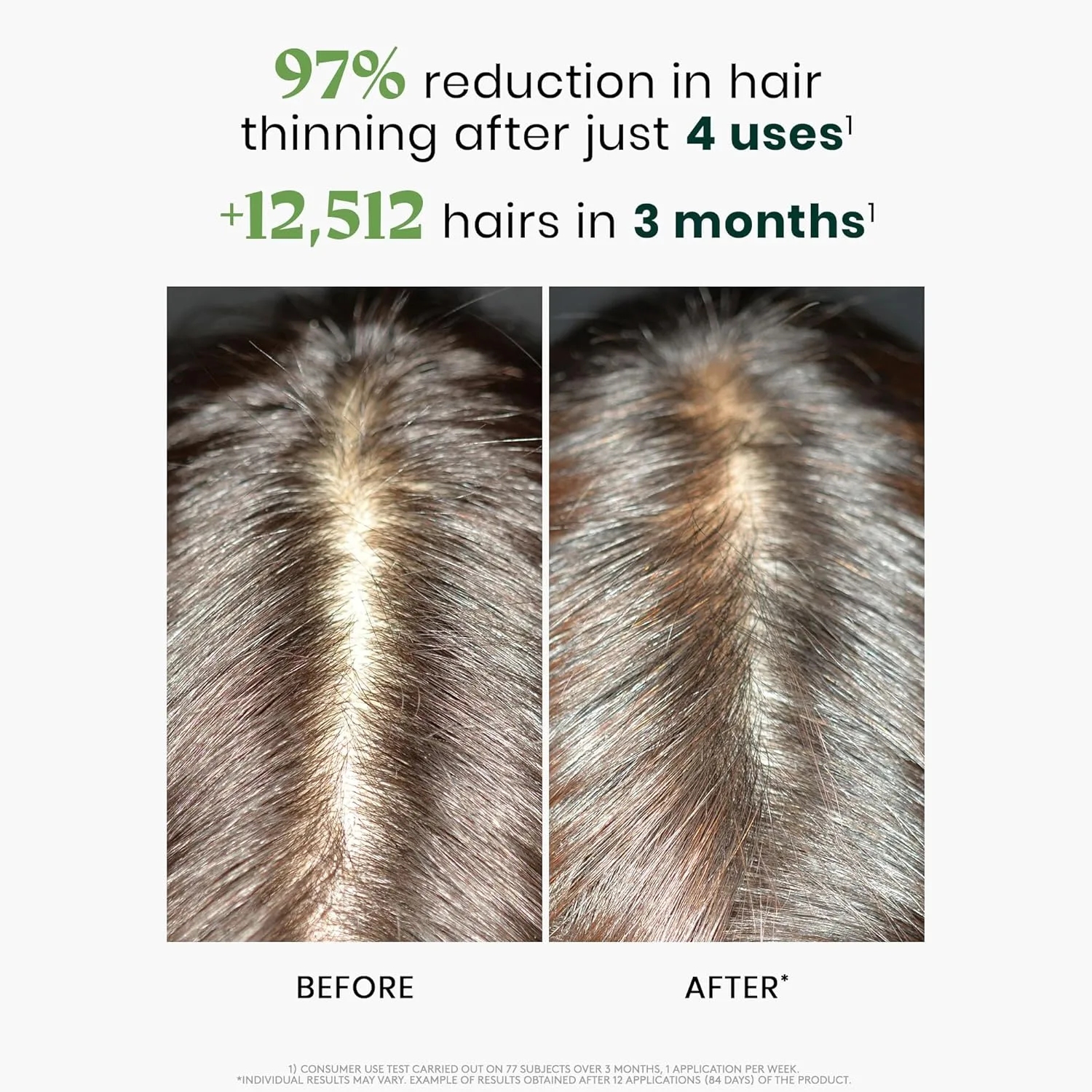 Rene Furterer Triphasic Reactional Concentrated Serum для истонченных волос из-за стресса, послеродового периода, сезонных изменений, 12 шт, 3-месячный курс 4,7 мл (12 шт.) — фото 3