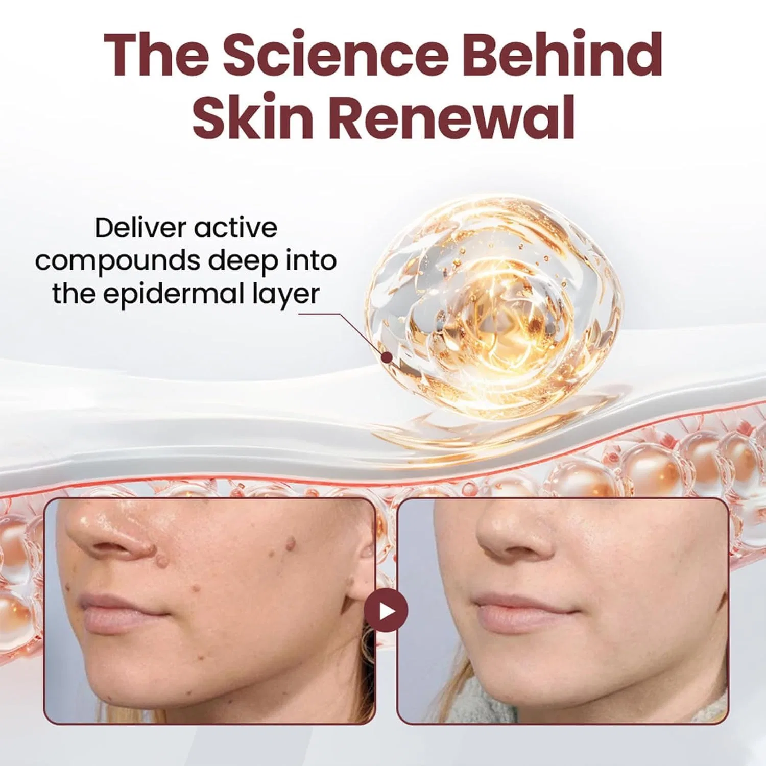 Крем для тела Biancat Keraerase Renewal Skin Treatment, 2 шт Generisch — фото 4